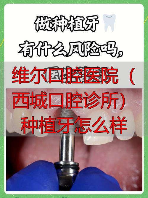 维尔口腔医院(西城口腔诊所)种植牙怎么样_北京维尔口腔_维尔口腔医院