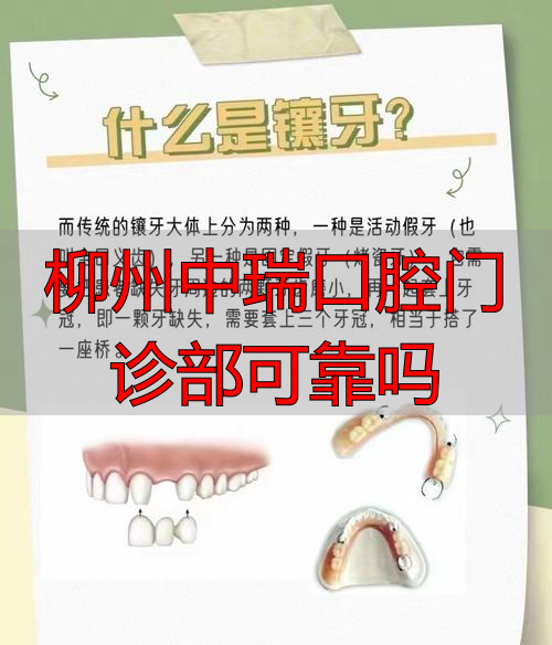 柳州华喜口腔种植优势_柳州中瑞口腔门诊部可靠吗_柳州中瑞口腔种植牙齿