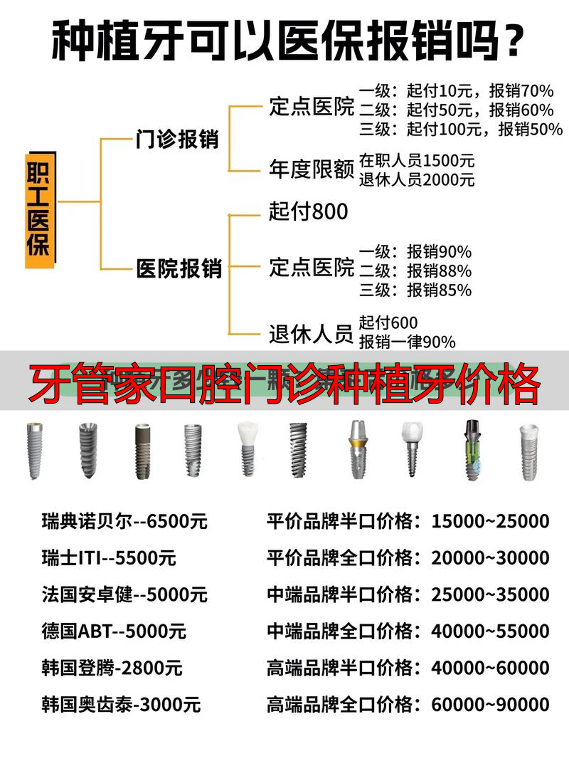 牙管家口腔医院价格_牙管家口腔门诊种植牙价格_牙管家种植牙