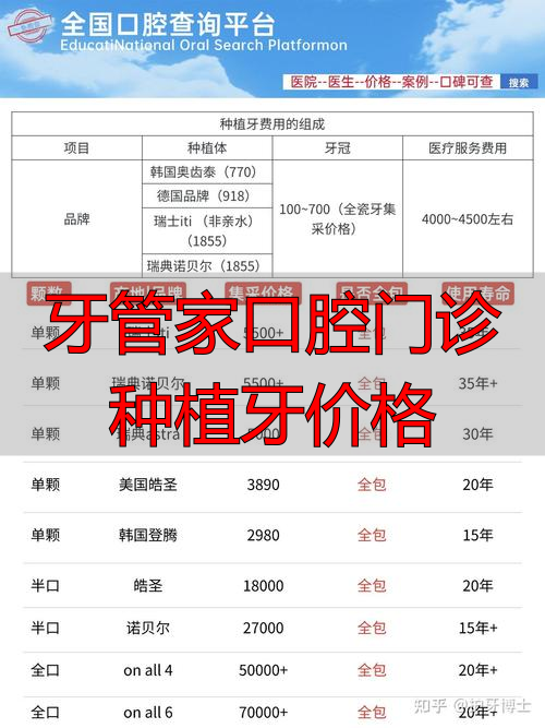 牙管家种植牙_牙管家口腔医院价格_牙管家口腔门诊种植牙价格