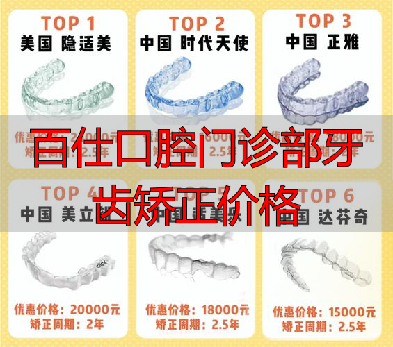百仕口腔矫正多少钱？从传统钢牙到时代天使、隐适美价格大盘点