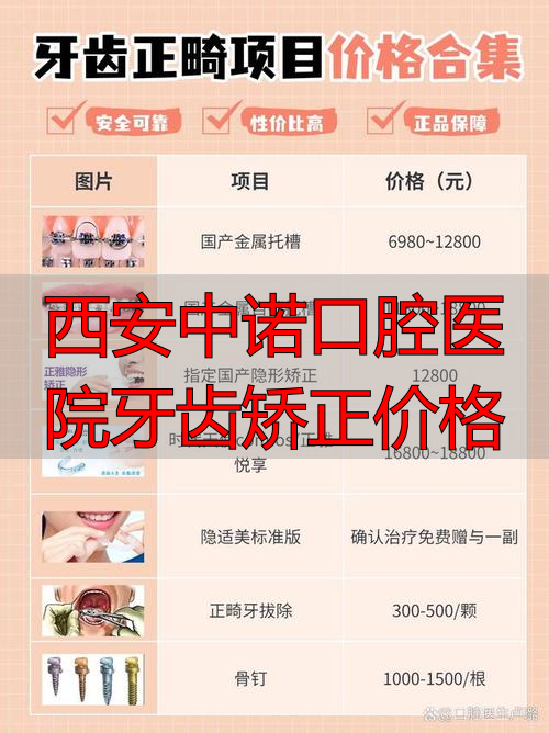 西安中诺口腔医院牙齿矫正价格_西安中诺口腔医生_西安中诺口腔医院种植牙多少钱