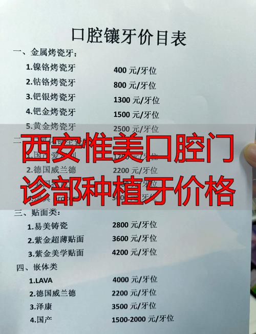西安口腔牙齿种植价格_西安惟美口腔门诊部种植牙价格_西安牙科医院种植