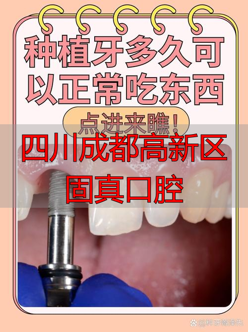四川成都高新区固真口腔_成都高新口腔医院_成都四川口腔医院怎么样