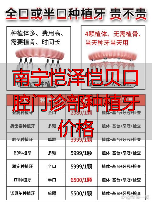 南宁凯泽口腔诊所_南宁恺泽恺贝口腔_南宁恺泽恺贝口腔门诊部种植牙价格
