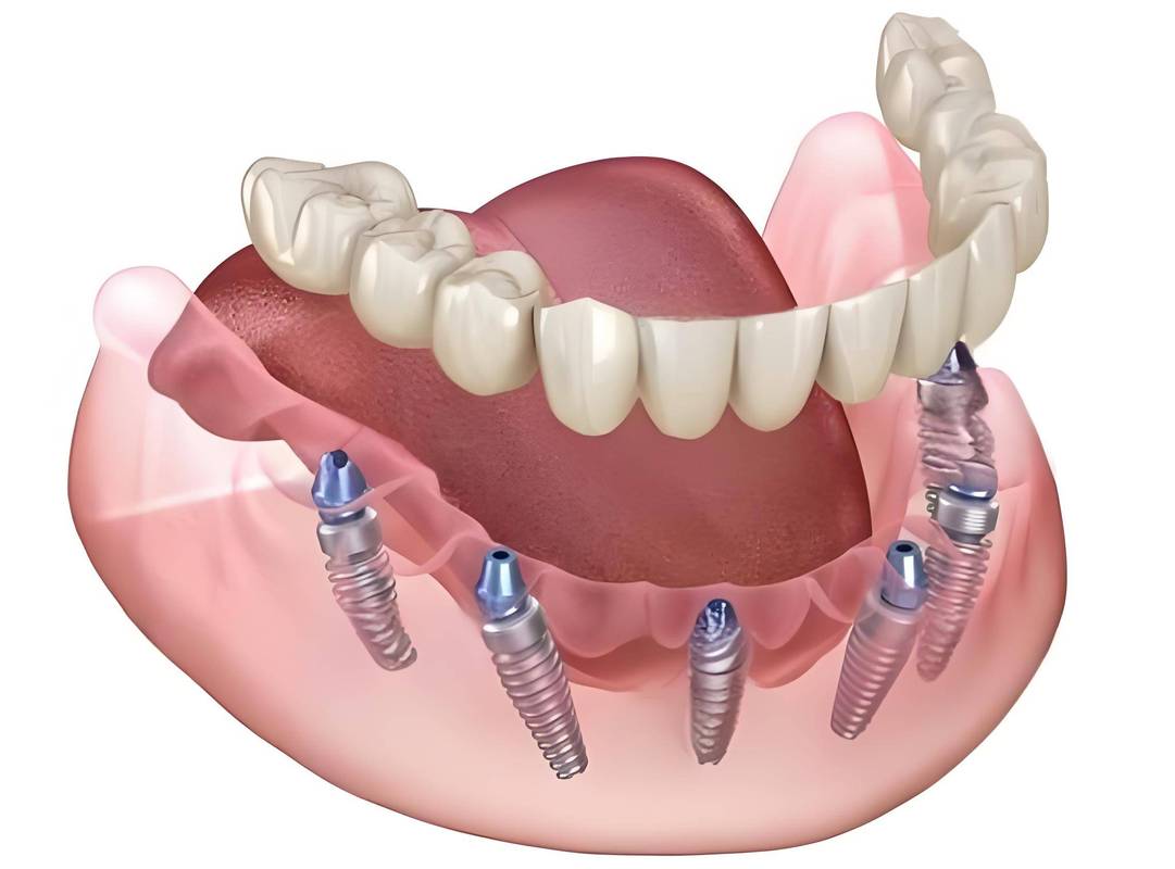 上海维乐口腔金文哲_上海维乐口腔金文哲_上海维乐口腔金文哲