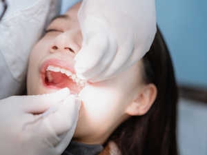 武汉优益佳口腔口碑怎么样?价格贵不贵?种植牙矫正牙修复牙1400起,附医生价格表地址预约方式