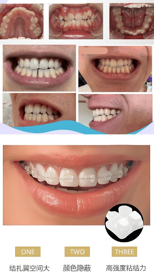 怀化赖尔口腔牙齿矫正_省湘潭赖尔口腔总院_怀化牙齿矫正医院