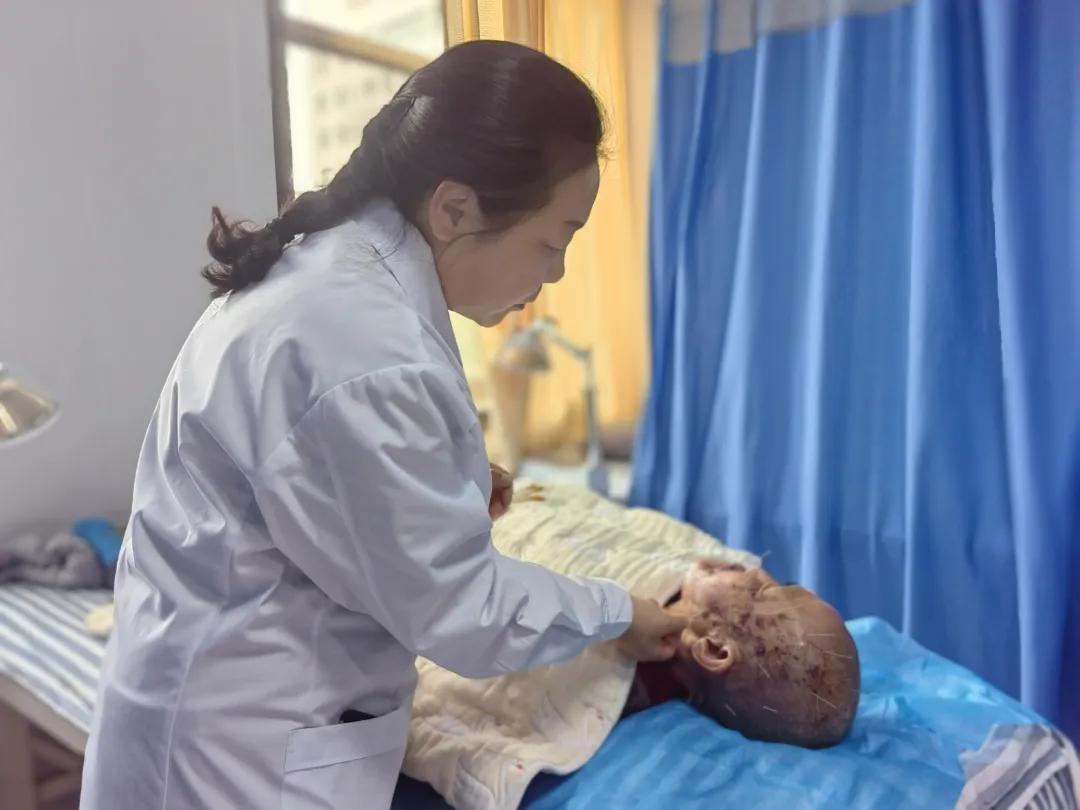 火针疗法缓解高龄患者神经痛_张掖口腔医院排名_张掖市中医医院针灸科火针治疗三叉神经带状疱疹