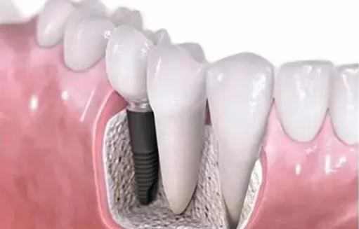 广州广大口腔门诊部(荔湾院区)熊含颖 广大口腔荔湾院区熊含颖医生怎么样？广州牙科排名前五有它吗？