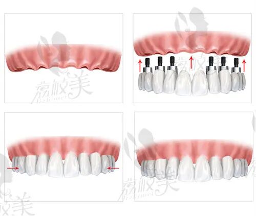 荆州咿呀雅美口腔沙市门诊部（沙市区总院）怎么样 荆州沙市咿呀雅美口腔总院种植牙技术怎么样？看用户评价怎么说